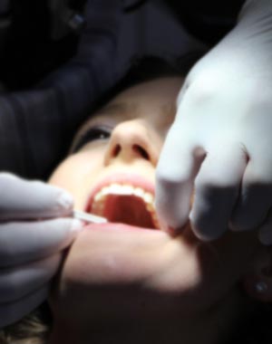 Türk Dişhekimleri Birliği 2022 yılı ağız diş sağlığı muayene ve tedavi ücret tarifesi